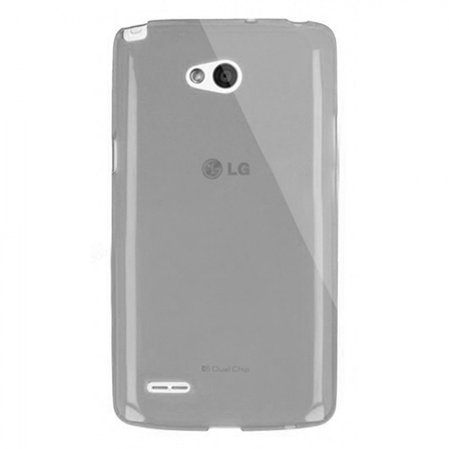 LG L80 (D380) Kılıf Soft Silikon Şeffaf-Siyah Arka Kapak