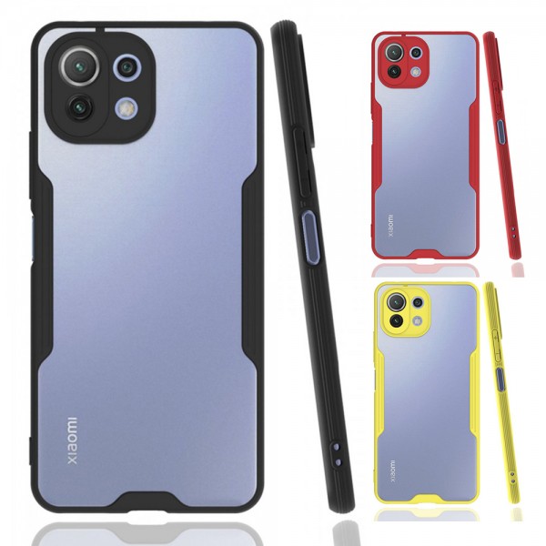 Xiaomi Mi 11 Lite Kılıf Platin Matte Silikon Arka Kapak&hellip;